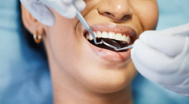Best Urgent Care for Lost Fillings or Crowns in New Paris, OH